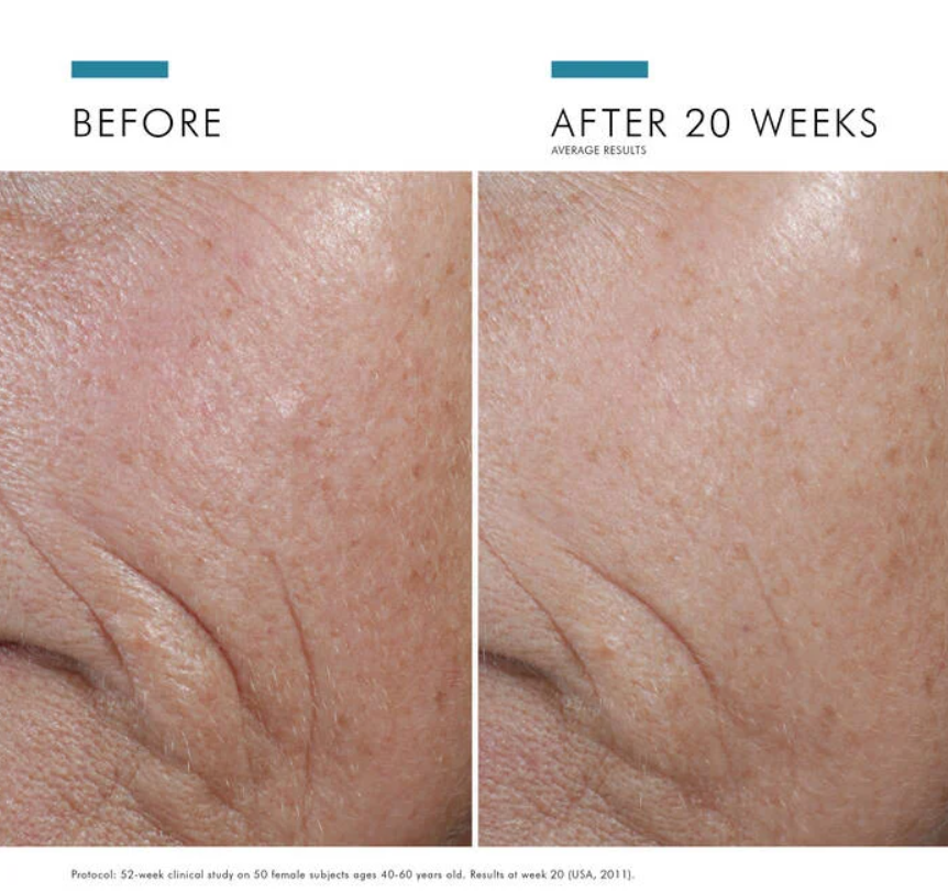 SkinCeuticals A.G.E. Interrupter Ultra Sérum Reafirmante 30 ml